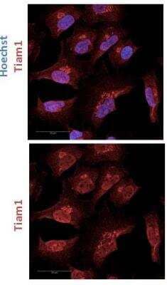 Immunocytochemistry/ Immunofluorescence TIAM1 Antibody