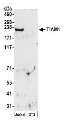 Western Blot TIAM1 Antibody