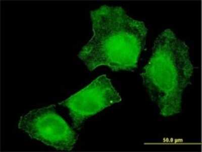 Immunocytochemistry/Immunofluorescence: TIAM2 Antibody (3C1) [H00026230-M01] - Analysis of monoclonal antibody to TIAM2 on HeLa cell . Antibody concentration 10 ug/ml.