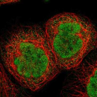 Immunocytochemistry/ Immunofluorescence TIAM2 Antibody