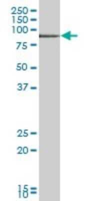 Western Blot TIAM2 Antibody