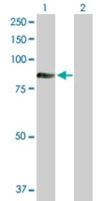 Western Blot: TIAM2 Antibody [H00026230-D01P] - Analysis of TIAM2 expression in transfected 293T cell line by TIAM2 polyclonal antibody.Lane 1: TIAM2 transfected lysate(70.80 KDa).Lane 2: Non-transfected lysate.