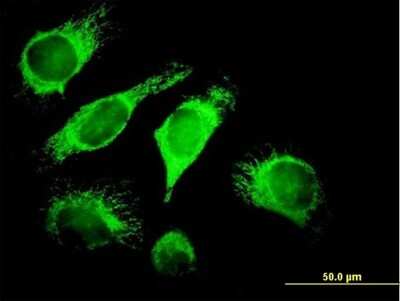 Immunocytochemistry/Immunofluorescence: TID1 Antibody [H00009093-B01P] - Analysis of purified antibody to DNAJA3 on HeLa cell. (antibody concentration 10 ug/ml)