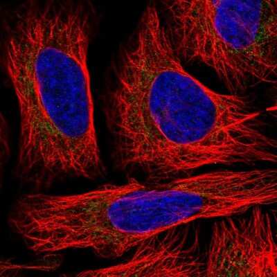 Immunocytochemistry/Immunofluorescence: TID1 Antibody [NBP2-33416] - Immunofluorescent staining of human cell line U-2 OS shows localization to mitochondria.