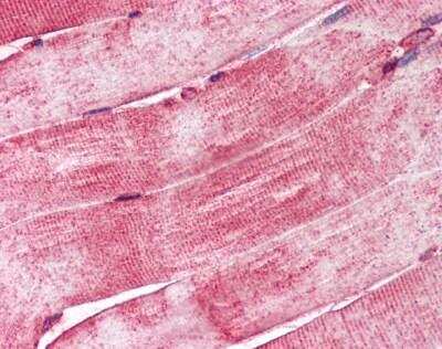 Immunohistochemistry-Paraffin: TID1 Antibody [NBP1-39496] - Analysis of anti-DNAJA3 / TID1 antibody with human skeletal muscle at concentration 10 ug/ml.