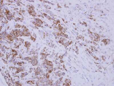 Immunohistochemistry-Paraffin: TID1 Antibody [NBP2-20633] - Immunohistochemical analysis of paraffin-embedded BT483 xenograft, using antibody at 1:250 dilution.