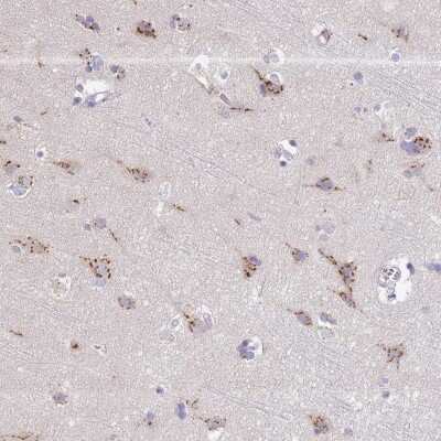 Immunohistochemistry-Paraffin: TID1 Antibody [NBP2-33416] - Staining of human cerebral cortex shows strong, granular cytoplasmic positivity in neuronal cells.