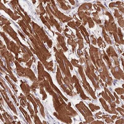 Immunohistochemistry-Paraffin: TID1 Antibody [NBP2-34066] - Staining of human heart muscle shows strong cytoplasmic positivity in myocytes.