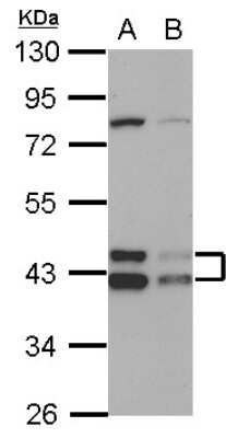 Western Blot: TID1 Antibody [NBP2-20633] - Sample (30 ug of whole cell lysate) A: HepG2 B: HCT116 10% SDS PAGE gel, diluted at 1:1000.