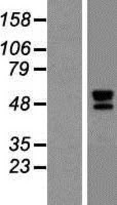 Western Blot: TID1 Overexpression Lysate (Adult Normal) [NBP2-10517] Left-Empty vector transfected control cell lysate (HEK293 cell lysate); Right -Over-expression Lysate for TID1.