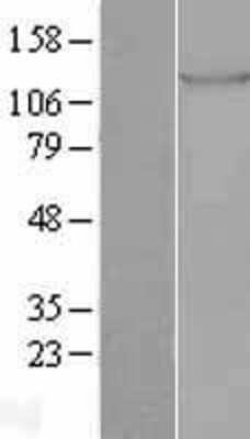 Western Blot: TIE1 Overexpression Lysate (Adult Normal) [NBL1-16909] Left-Empty vector transfected control cell lysate (HEK293 cell lysate); Right -Over-expression Lysate for TIE1.