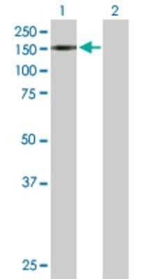 Western Blot: TIF1 alpha Antibody [H00008805-D01P] - Analysis of TRIM24 expression in transfected 293T cell line by TRIM24 polyclonal antibody.Lane 1: TRIM24 transfected lysate(116.80 KDa).Lane 2: Non-transfected lysate.