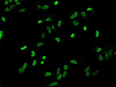 Immunocytochemistry/Immunofluorescence: TIF1 gamma Antibody [NBP2-98000] - Immunofluorescence staining of TIF1 gamma in U251MG cells. Cells were fixed with 4% PFA, permeabilzed with 0.1% Triton X-100 in PBS, blocked with 10% serum, and incubated with rabbit anti-Human TIF1 gamma polyclonal antibody (dilution ratio 1:200) at 4C overnight. Then cells were stained with the Alexa Fluor(R)488-conjugated Goat Anti-rabbit IgG secondary antibody (green). Positive staining was localized to .