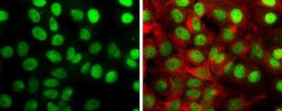 Immunocytochemistry/Immunofluorescence: TIF1 gamma Antibody [NBP3-13036] - TIF1 gamma antibody detects TIF1 gamma protein at nucleus by immunofluorescent analysis. Sample: MCF-7 cells were fixed in 4% paraformaldehyde at RT for 15 min. Green: TIF1 gamma stained by TIF1 gamma antibody (NBP3-13036) diluted at 1:2000. Red: alpha Tubulin, a cytoskeleton marker, stained by alpha Tubulin antibody [GT114] (NBP2-43837) diluted at 1:500.