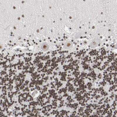 Immunohistochemistry-Paraffin: TIF1 gamma Antibody [NBP1-83747] - Staining of human cerebellum shows strong nuclear positivity in cells in granular layer.