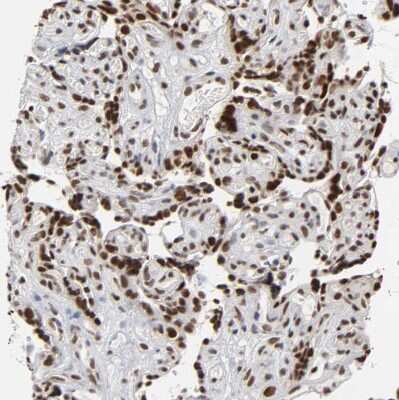 Immunohistochemistry-Paraffin: TIF1 gamma Antibody [NBP1-83747] - Staining of human placenta shows strong nuclear positivity in trophoblastic cells.