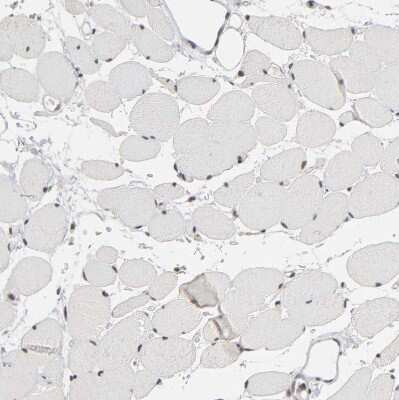 Immunohistochemistry-Paraffin: TIF1 gamma Antibody [NBP1-83747] - Staining of human skeletal muscle shows no positivity in myocytes as expected.