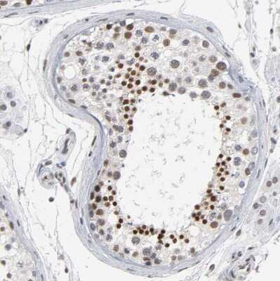 Immunohistochemistry-Paraffin: TIF1 gamma Antibody [NBP1-83747] - Staining of human testis shows moderate nuclear positivity in cells in seminiferous ducts.