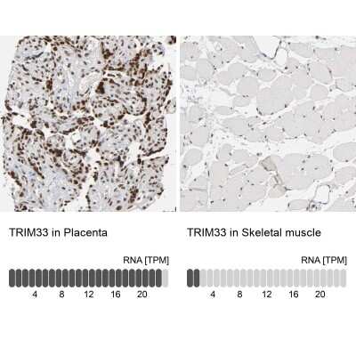 Immunohistochemistry-Paraffin: TIF1 gamma Antibody [NBP1-83747] - Staining in human placenta and skeletal muscle tissues using NBP1-83747 antibody. Corresponding TRIM33 RNA-seq data are presented for the same tissues.