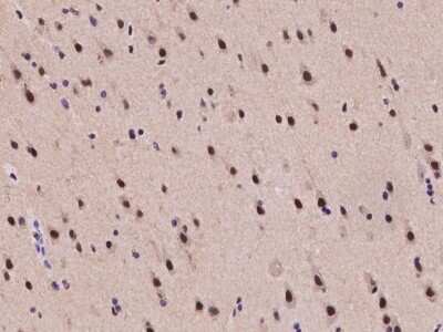 Immunohistochemistry-Paraffin: TIF1 gamma Antibody [NBP2-98000] - Immunochemical staining of human TIF1 gamma in human brain with rabbit polyclonal antibody at 1:2000 dilution, formalin-fixed paraffin embedded sections.