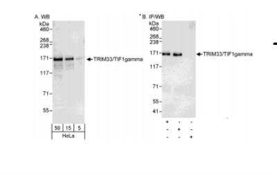 Western Blot: TIF1 gamma Antibody [NB100-57496] - Detection of Human TRIM33/TIF1gamma on HeLa whole cell lysate using NB100-57496. TRIM33/TIF1gamma was IPed by rabbit anti-TRIM33/TIF1gamma antibodies NB100-57497 and NB100-57498.