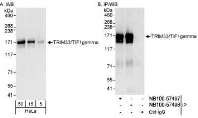 <b>Independent Antibodies Validation. </b>Western Blot: TIF1 gamma Antibody [NB100-57498] - Detection of Human TIF1gamma on HeLa whole cell lysate using NB100-57498. TIF1gamma was also immunoprecipitated by rabbit anti-TIF1gamma antibody NB100-57497.