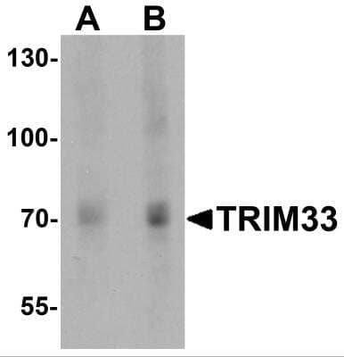 Western Blot: TIF1 gamma Antibody [NBP2-81762] - Analysis of TIF1 gamma in human liver tissue lysate with TIF1 gamma antibody at (A) 1 and (B) 2 ug/ml.