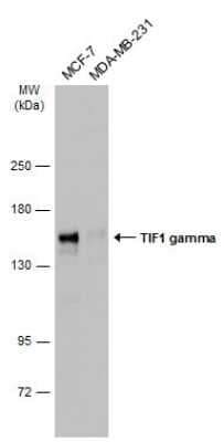 Western Blot: TIF1 gamma Antibody [NBP3-13036] - Various whole cell extracts (30 ug) were separated by 5% SDS-PAGE, and the membrane was blotted with TIF1 gamma antibody (NBP3-13036) diluted at 1:1000. The HRP-conjugated anti-rabbit IgG antibody (NBP2-19301) was used to detect the primary antibody.