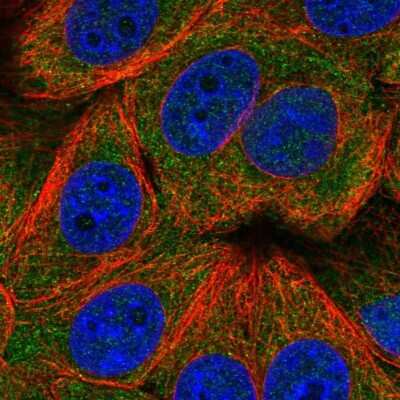 Immunocytochemistry/Immunofluorescence: TIGAR/C12orf5 Antibody [NBP2-38462] - Staining of human cell line MCF7 shows localization to cytosol.