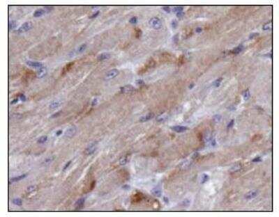 Immunohistochemistry: TIGAR/C12orf5 Antibody [NBP1-49534] - Analysis of TIGAR in mouse muscle.