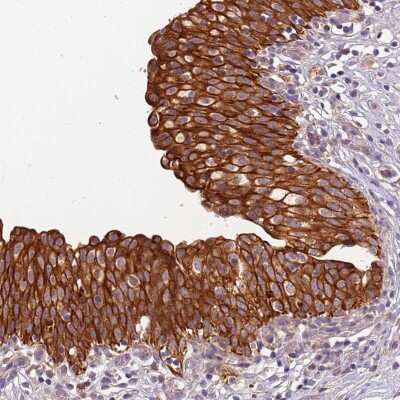 Immunohistochemistry: TIGAR/C12orf5 Antibody [NBP2-38462] - Staining of human urinary bladder shows strong cytoplasmic and membranous positivity in urothelial cells.