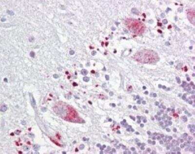 Immunohistochemistry-Paraffin: TIGAR/C12orf5 Antibody [NBP2-24754] - Analysis of human brain, cerebellum, using TIGAR antibody at 10 ug/ml.