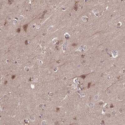 Immunohistochemistry-Paraffin: TIGAR/C12orf5 Antibody [NBP2-38522] - Staining of human cerebral cortex shows moderate cytoplasmic positivity in neurons.