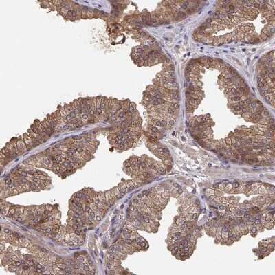 Immunohistochemistry-Paraffin: TIGAR/C12orf5 Antibody [NBP2-38522] - Staining of human prostate shows moderate  cytoplasmic positivity in glandular cells.