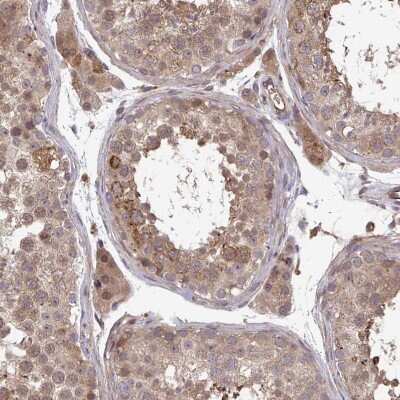 Immunohistochemistry-Paraffin: TIGAR/C12orf5 Antibody [NBP2-38522] - Staining of human testis shows moderate cytoplasmic positivity in cells in seminiferous ducts.