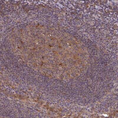 Immunohistochemistry-Paraffin: TIGAR/C12orf5 Antibody [NBP2-38522] - Staining of human tonsil shows weak to moderate cytoplasmic positivity in germinal center cells.