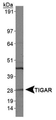 Western Blot: TIGAR/C12orf5 Antibody [NBP1-49534] -  Analysis of TIGAR in HeLa whole cell extracts.