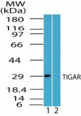 Western Blot: TIGAR/C12orf5 Antibody [NBP2-24507] - Analysis of human TIGAR in MCF7 cell lysate in the 1) absence and 2) presence of immunizing peptide using this antibody.