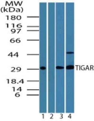 Western Blot: TIGAR/C12orf5 Antibody [NBP2-24754] - Analysis of TIGAR in human liver in the 1) absence and 2) presence of immunizing peptide, 3) mouse liver and 4) rat liver lysate using TIGAR antibody at 1, 4 and 2 ug/ml, respectively.