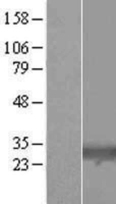 Western Blot: TIGAR Overexpression Lysate (Adult Normal) [NBL1-08147] Left-Empty vector transfected control cell lysate (HEK293 cell lysate); Right -Over-expression Lysate for TIGAR.