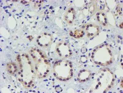 Immunohistochemistry-Paraffin: TIGD1 Antibody (4G9) [NBP2-03877] - Staining of paraffin-embedded Human Kidney tissue using anti-TIGD1 mouse monoclonal antibody.