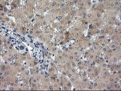 Immunohistochemistry-Paraffin: TIGD1 Antibody (4G9) [NBP2-03877] Staining of paraffin-embedded Human liver tissue using anti-TIGD1 mouse monoclonal antibody.