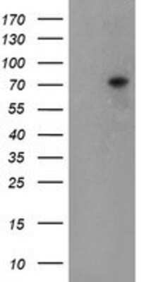 Western Blot: TIGD1 Antibody (4G9) [NBP2-03877] - HEK293T cells were transfected with the pCMV6-ENTRY control (Left lane) or pCMV6-ENTRY TIGD1 (Right lane) cDNA for 48 hrs and lysed. Equivalent amounts of cell lysates (5 ug per lane) were separated by SDS-PAGE and immunoblotted with anti-TIGD1.