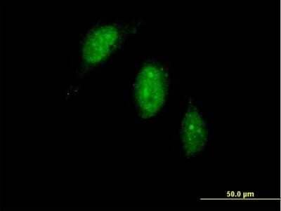 Immunocytochemistry/Immunofluorescence: TIGD1 Antibody [H00200765-B01P] - Analysis of purified antibody to TIGD1 on HeLa cell. (antibody concentration 10 ug/ml)