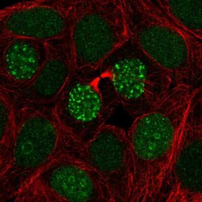 Immunocytochemistry/Immunofluorescence: TIGD1 Antibody [NBP2-47606] - Staining  human cell line MCF7 shows positivity in nucleus and nucleoli.