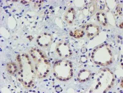 Immunohistochemistry: TIGD1 Antibody (OTI4G9) - Azide and BSA Free [NBP2-74519] - Staining of paraffin-embedded Human Kidney tissue using anti-TIGD1 mouse monoclonal antibody.