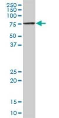 Western Blot: TIGD1 Antibody [H00200765-B01P] - Analysis of TIGD1 expression in Hela S3 NE.