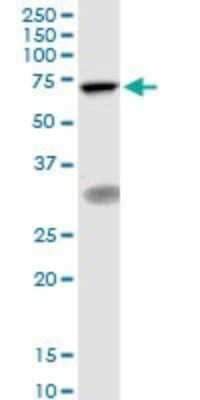 Western Blot: TIGD1 Antibody [H00200765-B01P] - Analysis of TIGD1 expression in MCF-7.