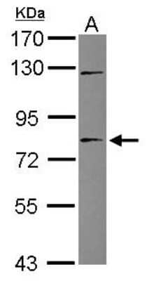 Western Blot: TIGD1 Antibody [NBP2-20640] - Sample (20 ug) A: HeLa nucleus 7. 5% SDS PAGE gel, diluted at 1:1000.
