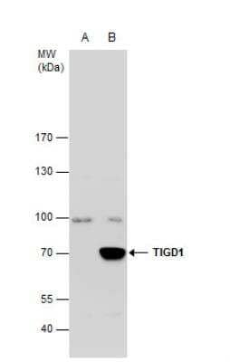 Western Blot: TIGD1 Antibody [NBP2-20640] - A. 30 ug 293T whole cell extract B. 30 ug whole cell extract of human TIGD1-transfected 293T cells 7.5 % SDS-PAGE TIGD1 antibody dilution: 1:5000